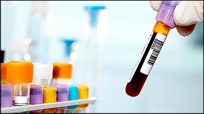blood sample