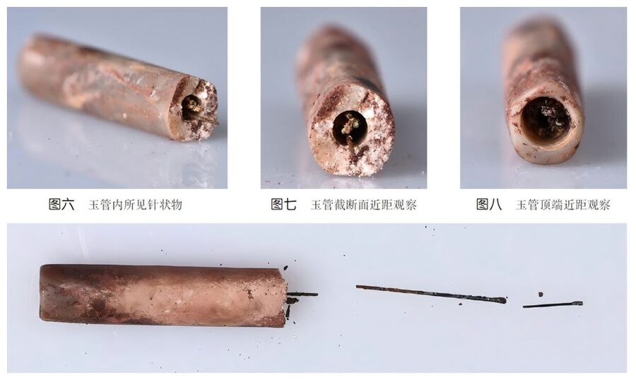 Acupuncture Needles