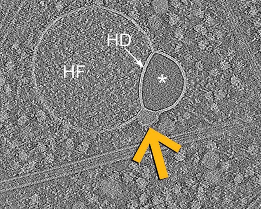 Click to enlarge hemifusome
