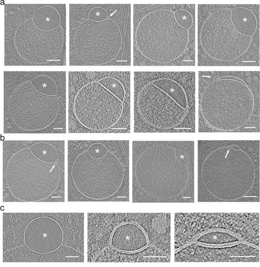 Click to enlarge Hemifusome structures variety shapes.