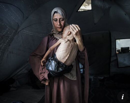 child starvation gaza genocide