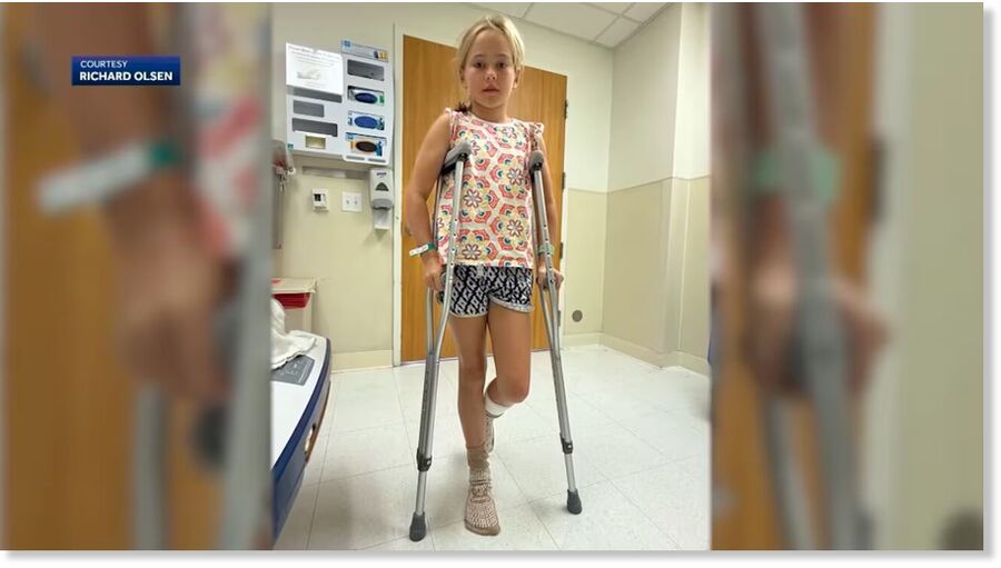 Corale Olsen, 9, suffered puncture wounds and bruising on her leg when she was bitten by a sea lion during surf camp.