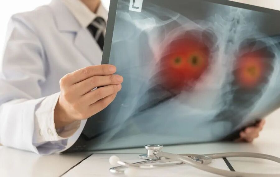 Click to enlarge Lungs X-ray