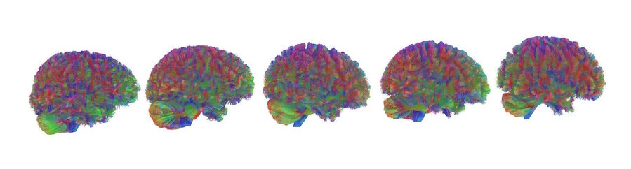 brain age five stages