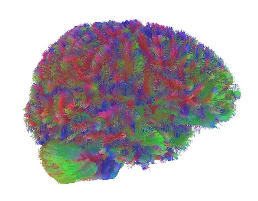 Click to enlarge brain topography childhood