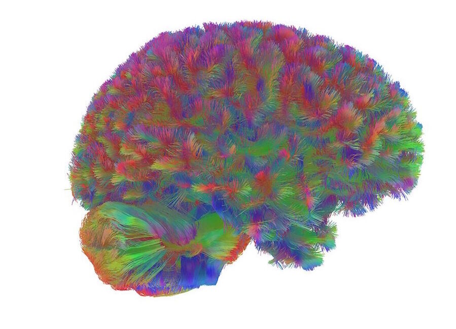 Click to enlarge adolescent brain topography neural development