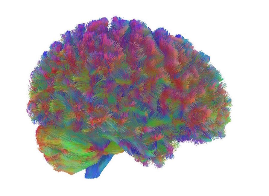 Click to enlarge adult brain topography neural development