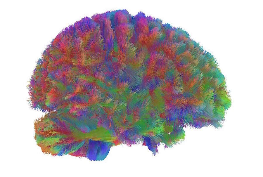 Click to enlarge topography early ageing brain neural decline