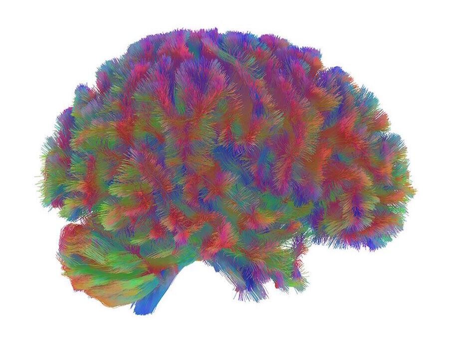Click to enlarge topography late ageing brain