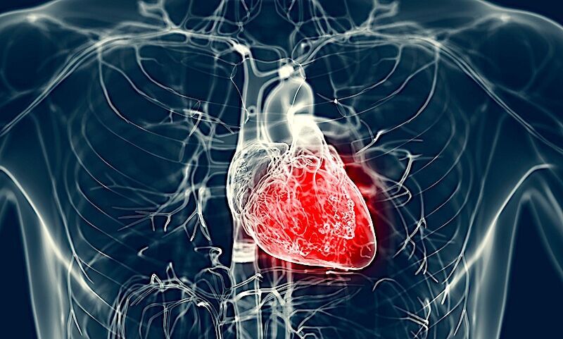 Click to enlarge Heart tissue