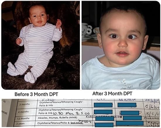 DPT Vaccine