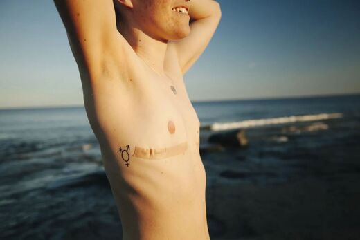 Plastic surgeons ditch gender ideology - New guidelines rule out medical transition for kids