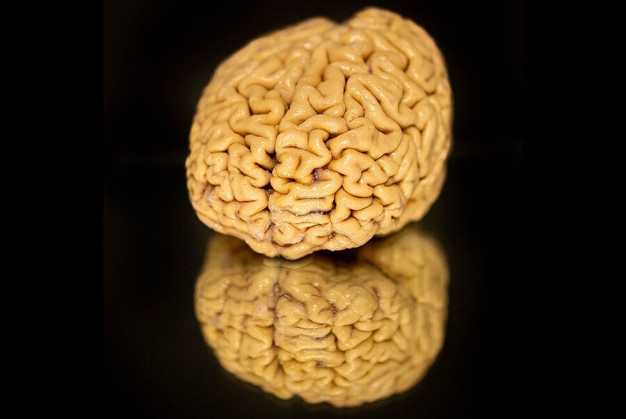 Click to enlarge human brain reflection table super agers more neurons