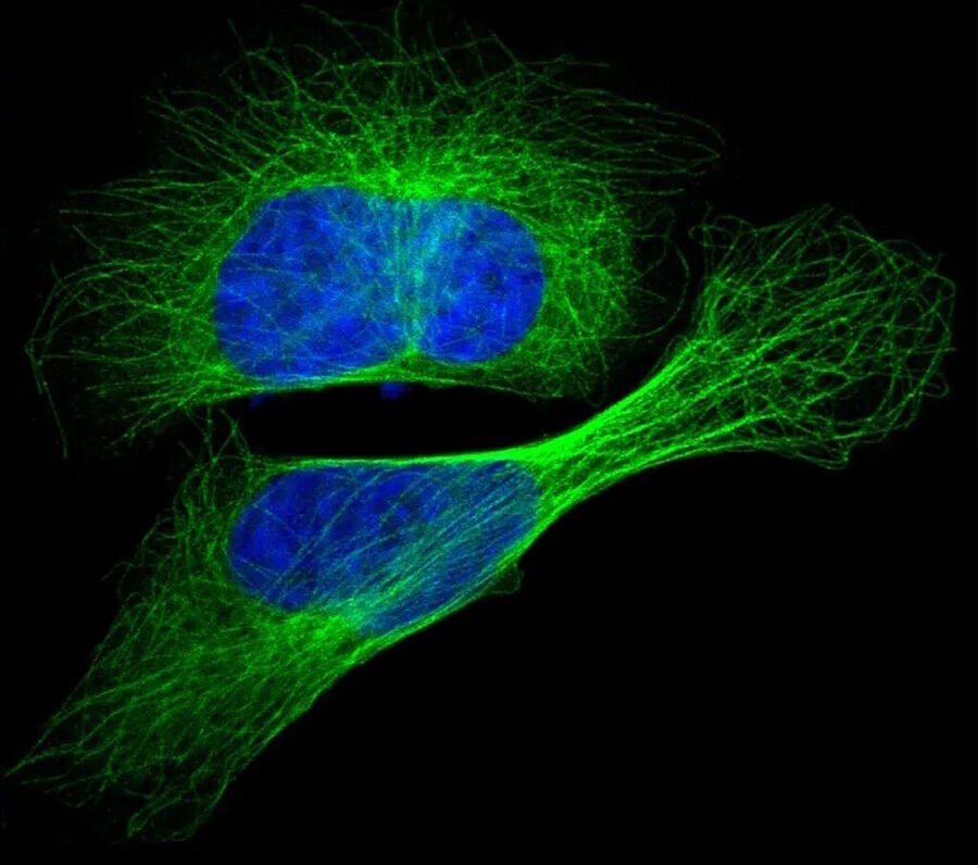 cell nucleus microtubules