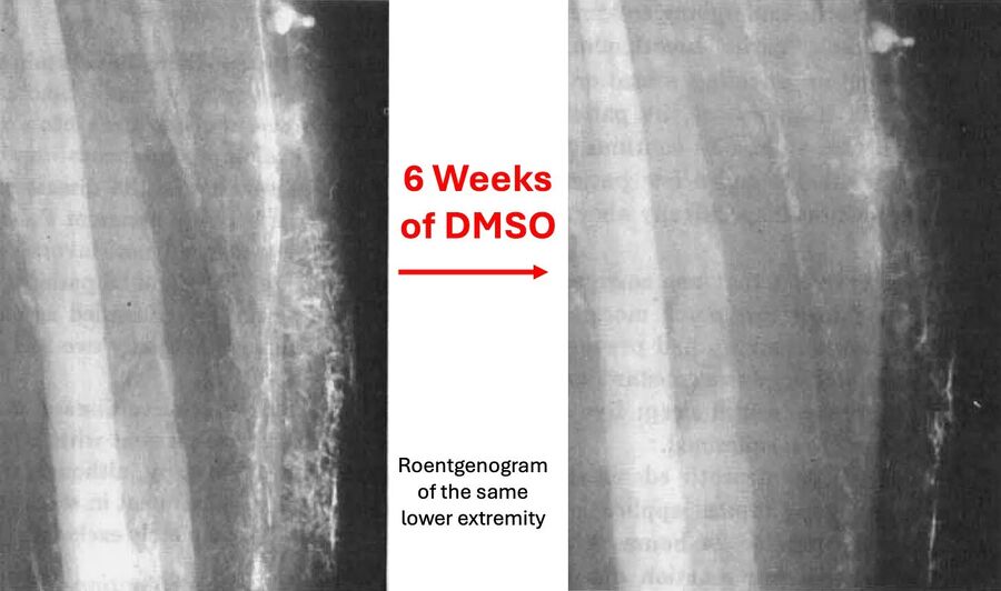 DMSO rocks