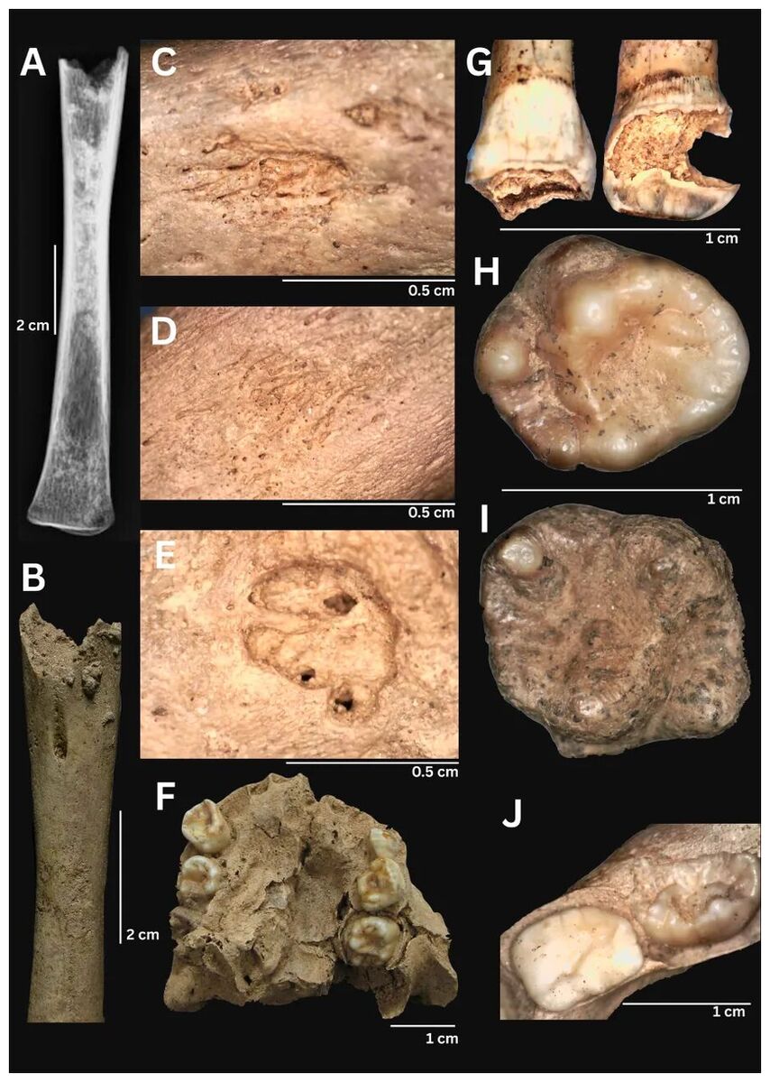 Click to enlarge Decayed Teeth