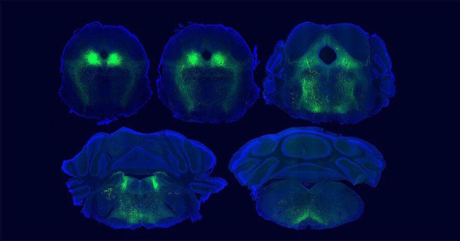 brain pain circuits fluorescent mapping