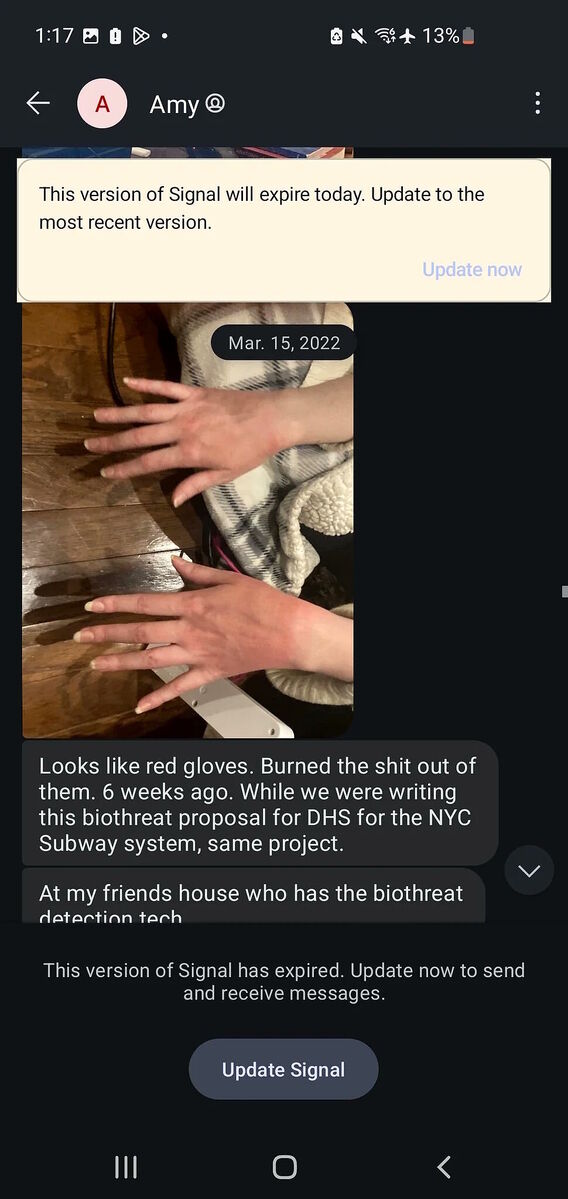 burned hands energy weapon amy eskridge messages scientist dead