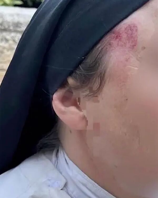 Click to enlarge nun attacked jerusalem head injury