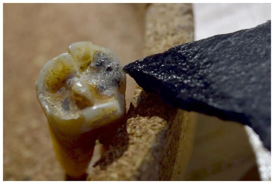 Siberia Molar