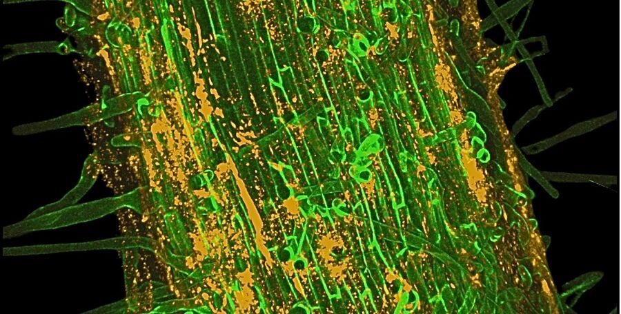 Click to enlarge fungi microbes partnership stress soil deficiencies