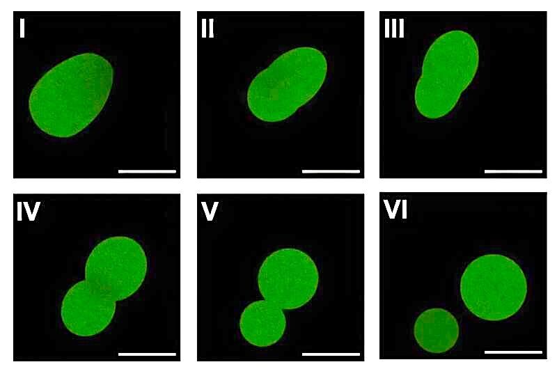 Click to enlarge Fluorescent microscopy of SpudCel