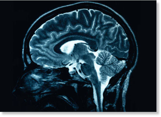 brain scan