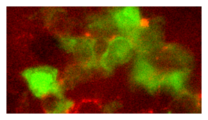 Click to enlarge Lymphocyte Cells