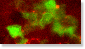 lymphocyte cells