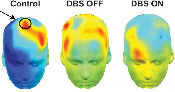 Click to enlarge Brain Images