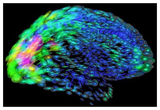 Click to enlarge Super Brain