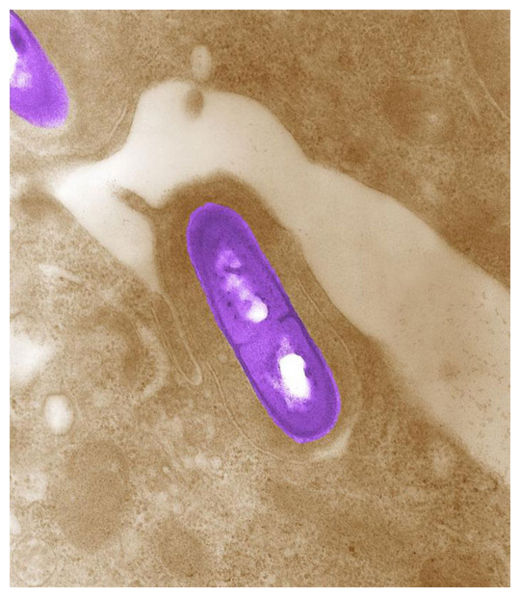 Click to enlarge Listeria bacterium