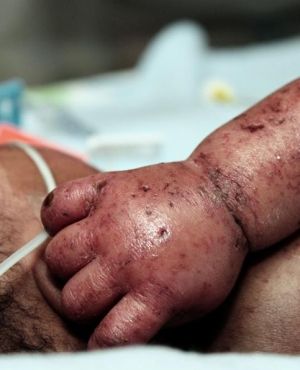 Click to enlarge A newborn baby, named Caleb Hope