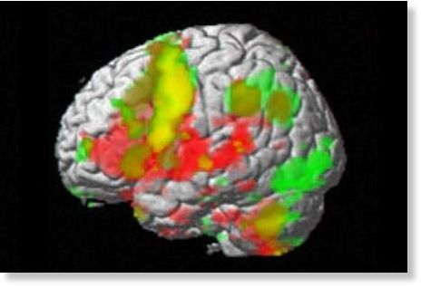 Click to enlarge brain