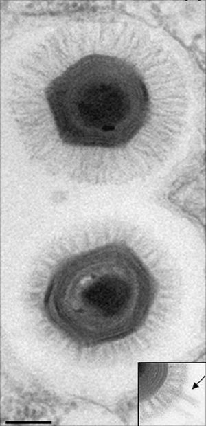 Megavirus