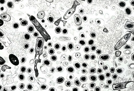  Threat: Bacillus anthrax spores seen through a microscope. The White House is considering plans to test the anthrax vaccine on children in the event of a bioterrorism attack