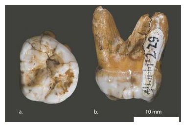 Ancient Molar