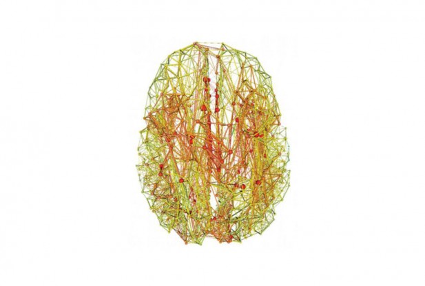 Areas of The Brain