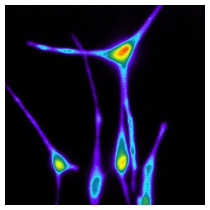 Melanocyte