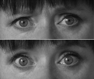 Eye Movements