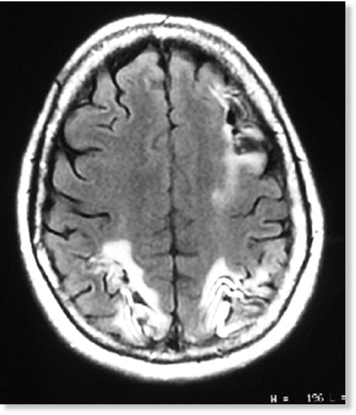 Brain image