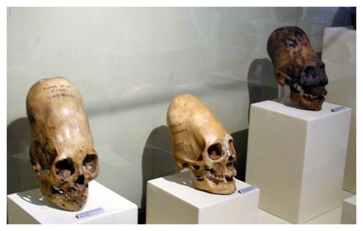 Ancient Skull_1