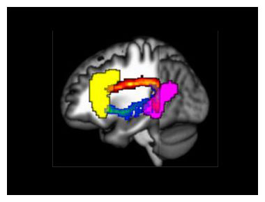 The Brain