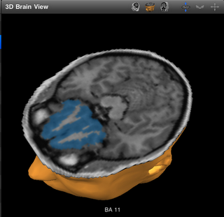 brain cross-section
