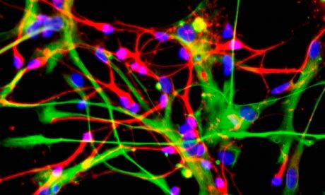 Brain cell activity