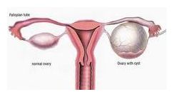 Ovary
