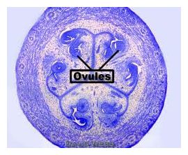 Ovary_1