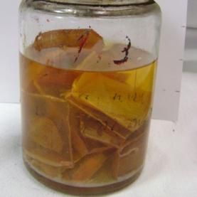 brain tissue mental illness DNA