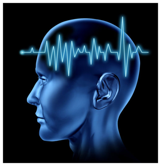 Brain Circulation