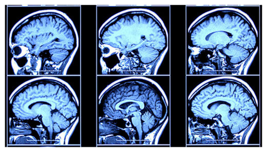 Click to enlarge Brain Scan